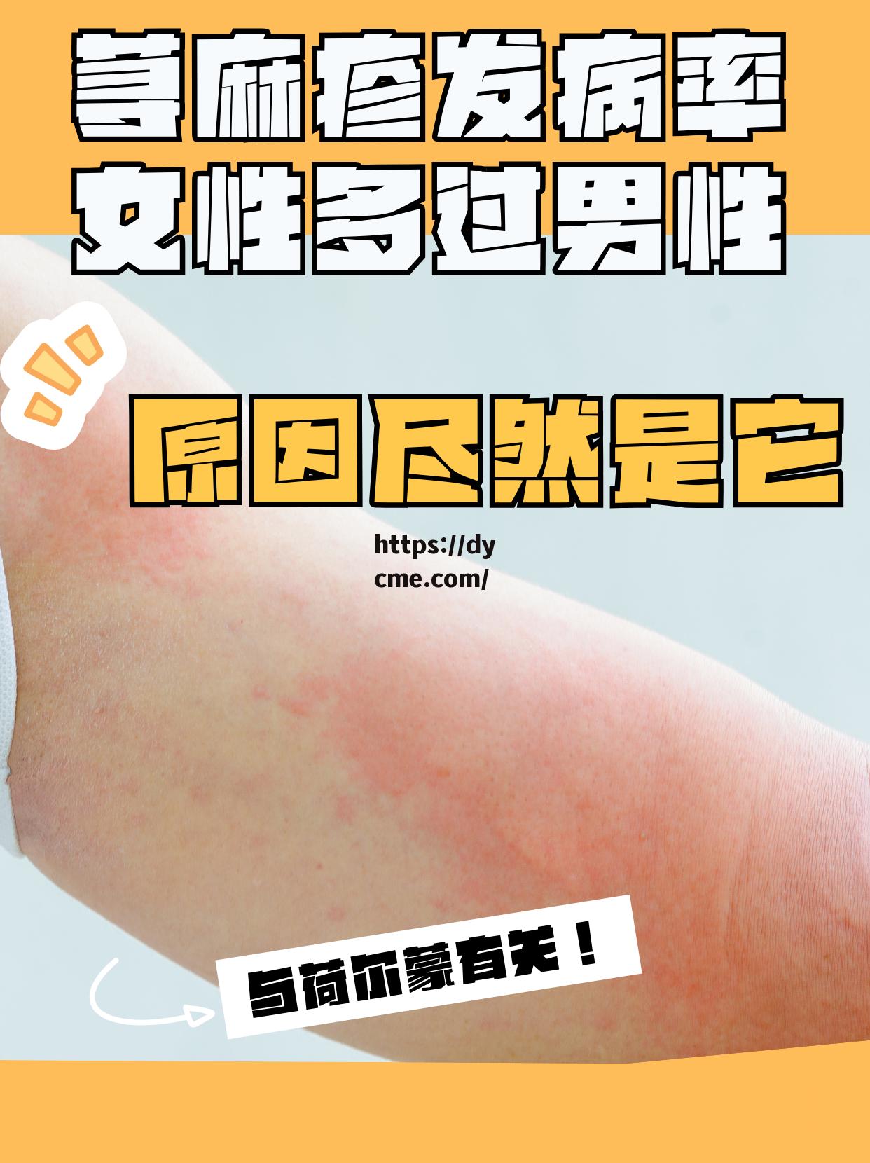 瘙痒难耐(攻出轨(瘙痒难忍成语意思)